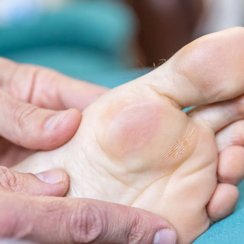 Blisters on Feet: Comprehensive Care Tips and Techniques
